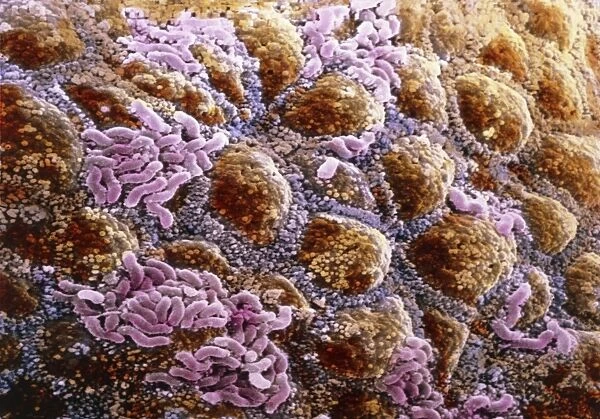 False-colour SEM of wall of colon, with bacteria