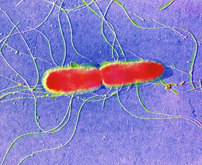 Framed Print : False-colour TEM Print of Salmonella typhi Bacteria