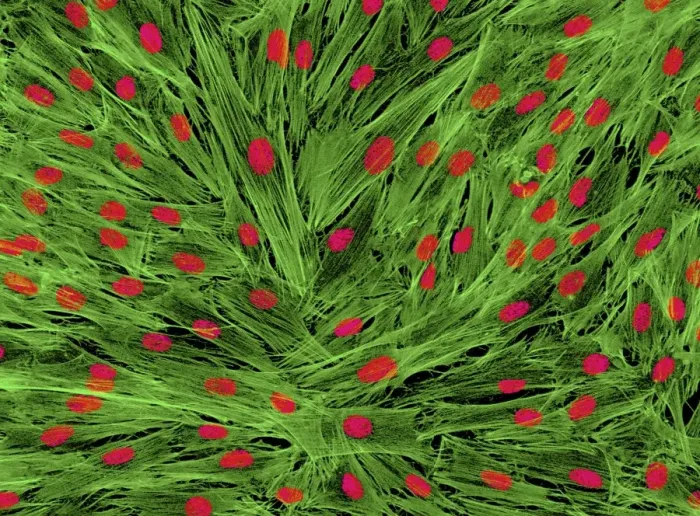 Framed Print : Fibroblast cells, x850 print