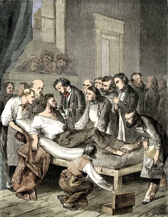 Framed Print : Colour Print of First Anaesthesia Use in Surgery Framed Print : Colour Print of First Anaesthesia Use in Surgery