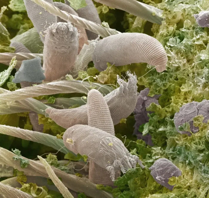 Framed Print : SEM Print of Gall Mites Framed Print : SEM Print of Gall Mites