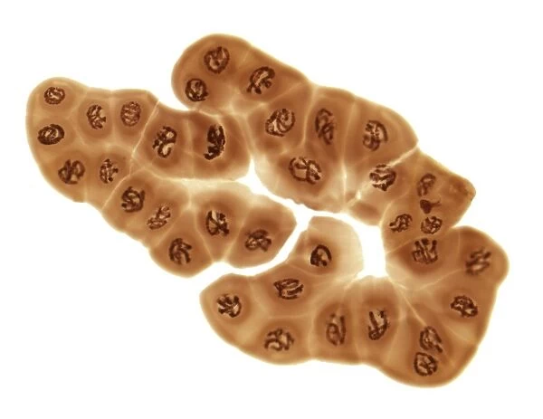 Giant chromosomes, light micrograph F006  /  9794