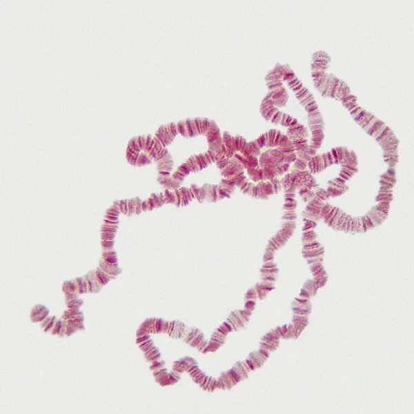 Giant chromosomes, light micrograph P657  /  0037