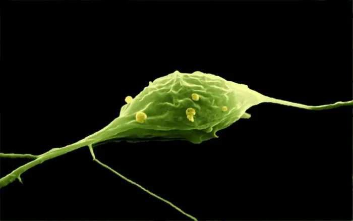 Framed Print : SEM Print of a Granule Nerve Cell Framed Print : SEM Print of a Granule Nerve Cell