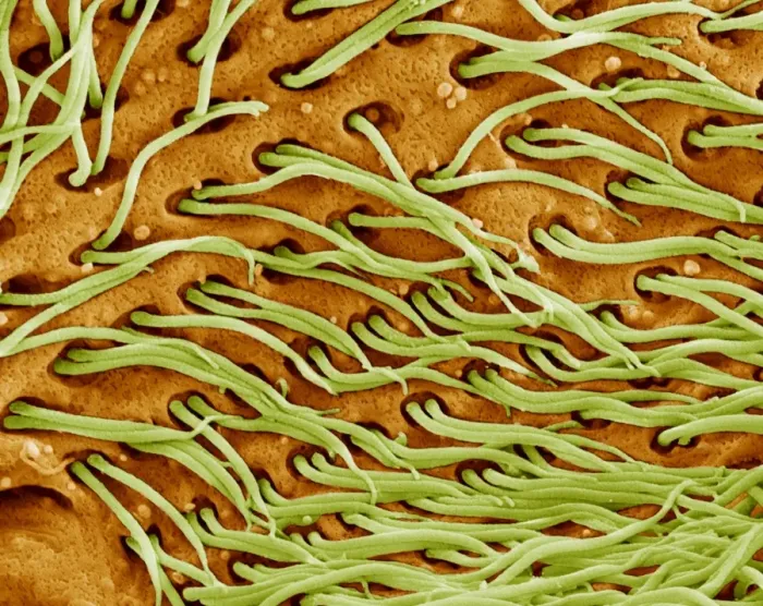 Framed Print : Protozoan Cilia Print, SEM Image of Microscopic Hairs