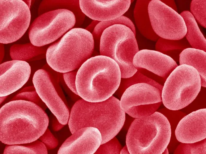 Framed Print : Red Blood Cells Print - SEM Image Framed Print : Red Blood Cells Print - SEM Image