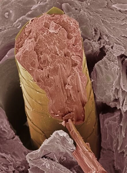 Hair, SEM. Hair fracture. Coloured scanning electron micrograph 