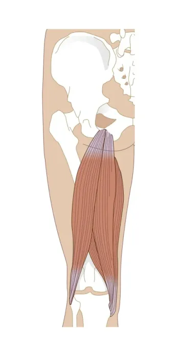 Framed Print : Hamstring Anatomy Print, Computer Artwork Framed Print : Hamstring Anatomy Print, Computer Artwork