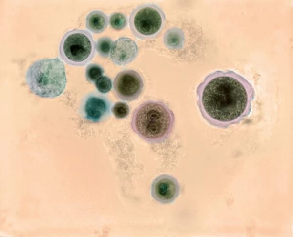 Hartmannella vermiformis protozoa cysts C016  /  9402