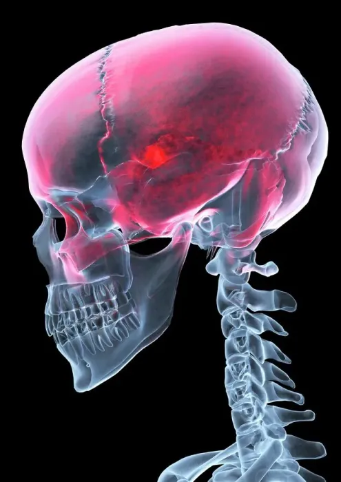 Framed Print : Lateral Skull X-ray Print Framed Print : Lateral Skull X-ray Print