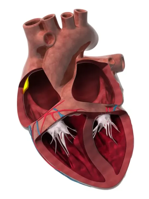 Framed Print : Heart Chambers and Sinus Node Print Framed Print : Heart Chambers and Sinus Node Print