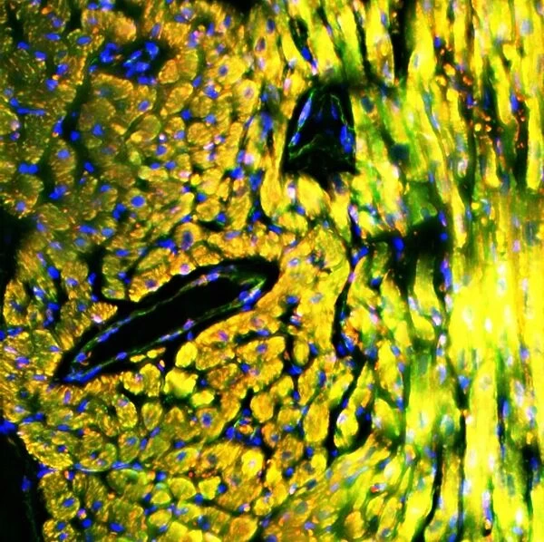 Heart muscle, fluorescence micrograph C016  /  8481
