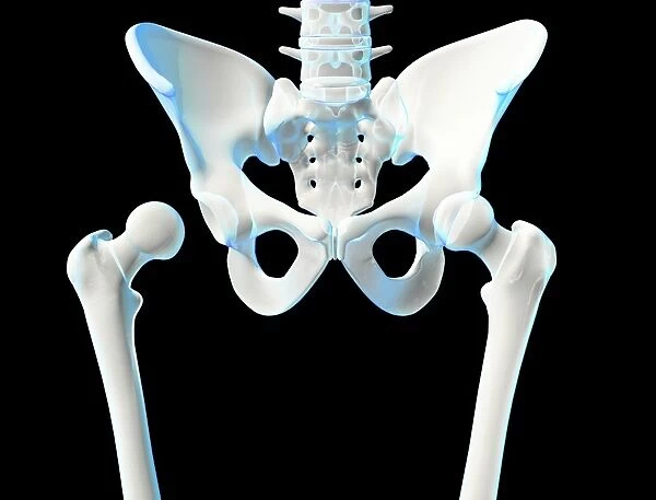 Hip joint bones and anatomy, artwork C014  /  2032