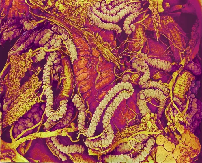 Framed Print : Hover Fly Gut Print, Coloured SEM Image