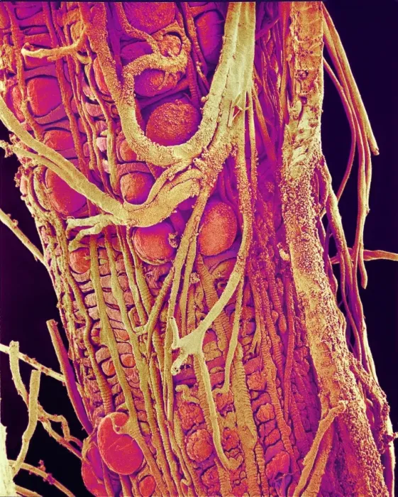 Framed Print : Hover Fly Gut Print, Coloured SEM Image Framed Print : Hover Fly Gut Print, Coloured SEM Image