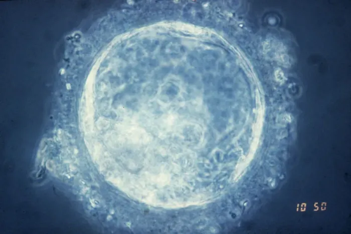 Framed Print : Human Blastocyst Print, Light Micrograph Framed Print : Human Blastocyst Print, Light Micrograph