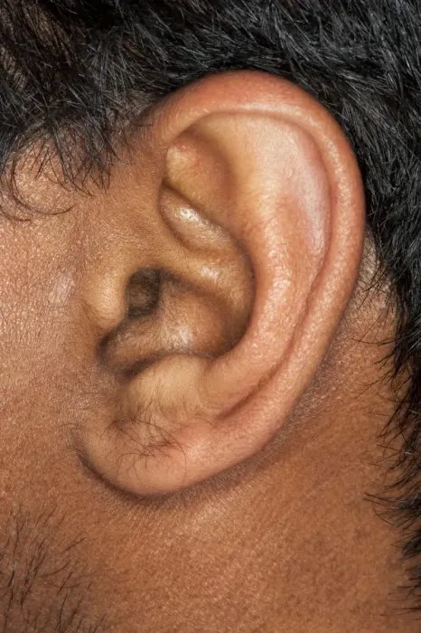 Framed Print : Human Ear Close-up Print Framed Print : Human Ear Close-up Print