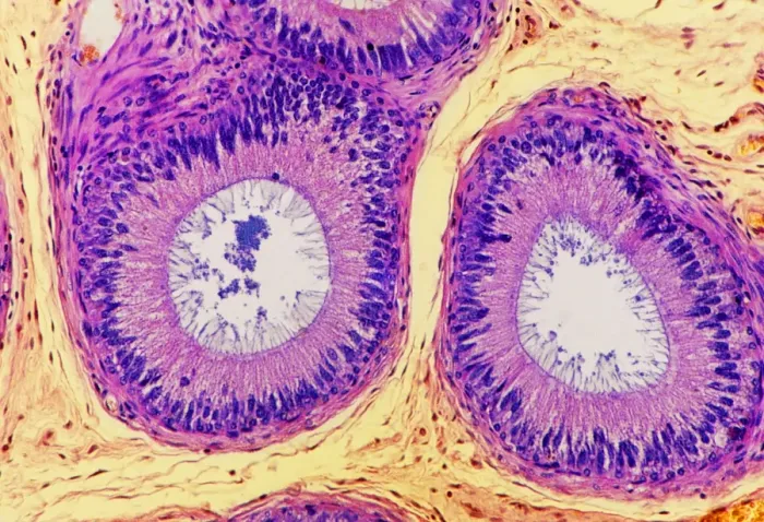 Framed Print : Human Epididymis Print, Light Micrograph