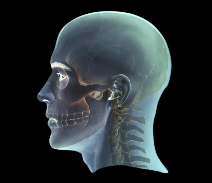 Framed Print : 3D CT Scan Print of a Human Head Profile Framed Print : 3D CT Scan Print of a Human Head Profile