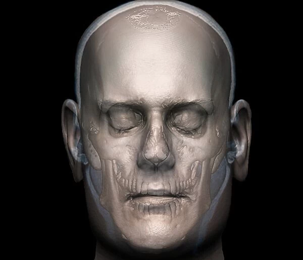 Human head, 3D CT scan F006  /  9109