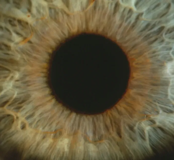 Framed Print : Human Iris and Pupil Print Framed Print : Human Iris and Pupil Print