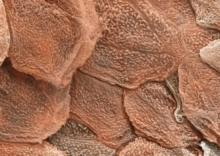 Framed Print : Human Skin Print, SEM Image of Epidermis Framed Print : Human Skin Print, SEM Image of Epidermis