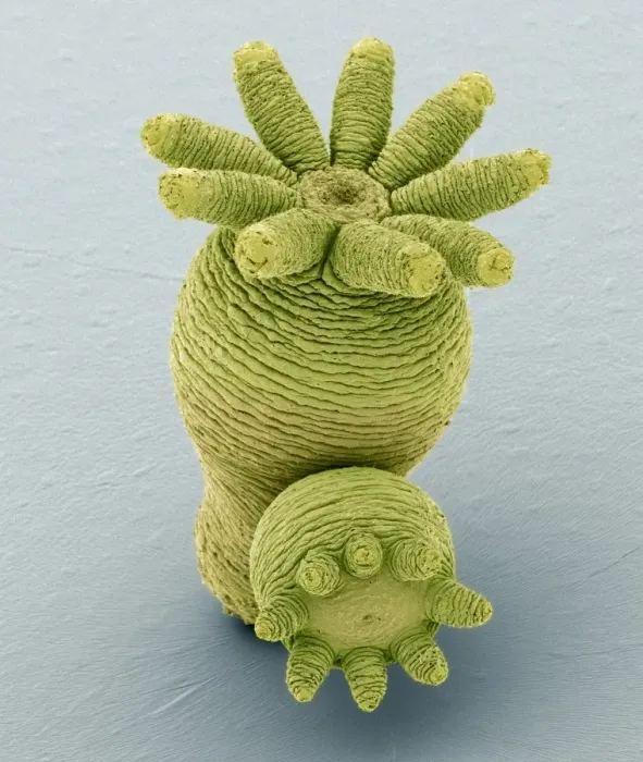 Framed Print : Hydra Budding Print, SEM Framed Print : Hydra Budding Print, SEM