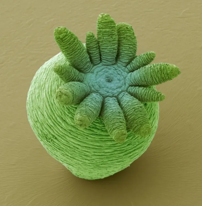 Framed Print : Hydra SEM Print, x60 magnification Framed Print : Hydra SEM Print, x60 magnification