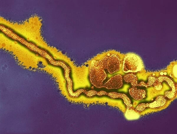 Influenza C virus, TEM