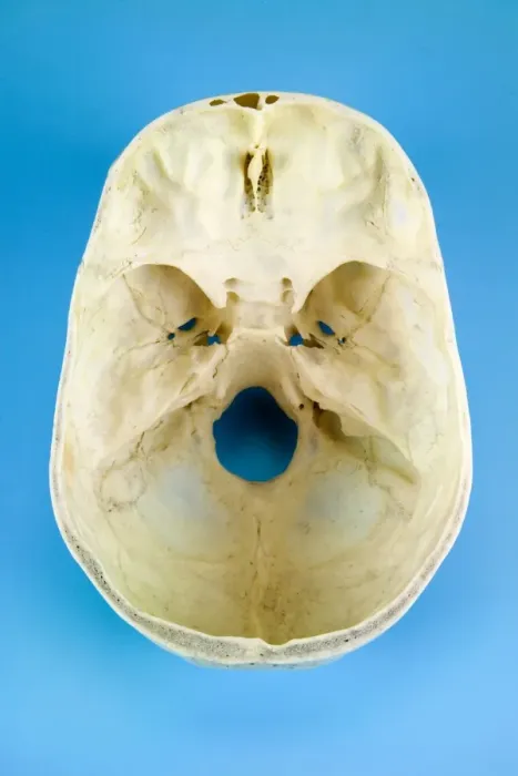 Framed Print : Top View of a Sectioned Human Skull Print