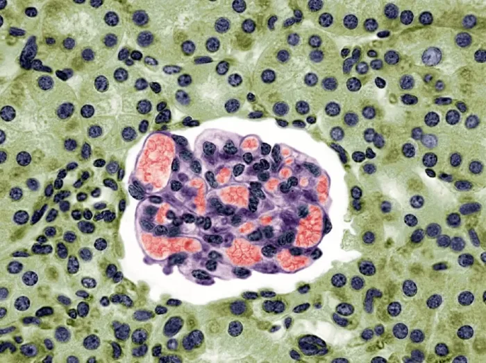 Framed Print : Kidney glomerulus Print, coloured light micrograph Framed Print : Kidney glomerulus Print, coloured light micrograph