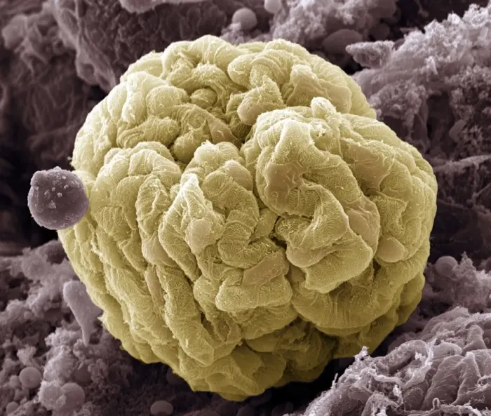 Framed Print : Kidney Glomerulus Print, SEM Colour Micrograph Framed Print : Kidney Glomerulus Print, SEM Colour Micrograph