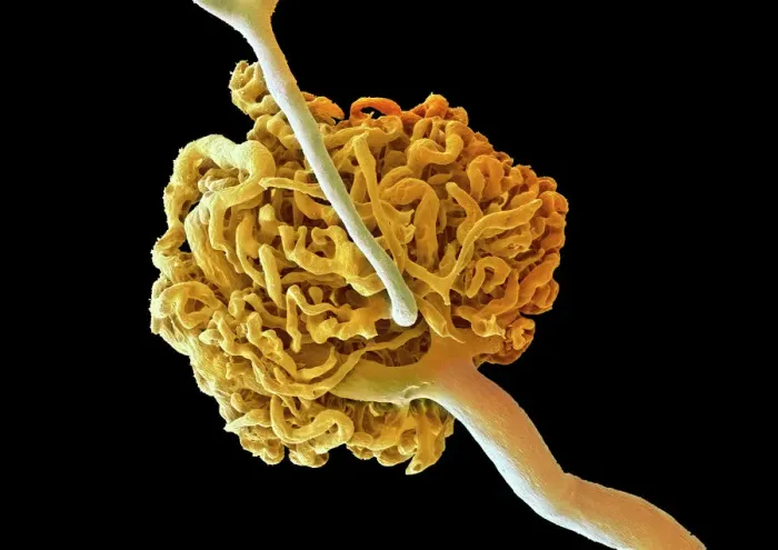 Framed Print : Coloured SEM Print of a Kidney Glomerulus Framed Print : Coloured SEM Print of a Kidney Glomerulus