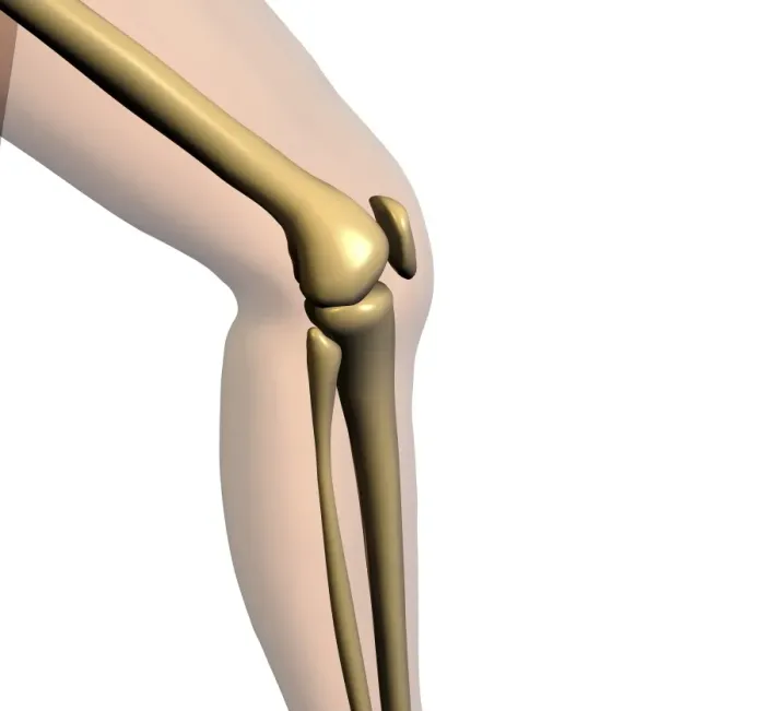 Framed Print : Computer artwork of a knee joint, seen from the side - Print Framed Print : Computer artwork of a knee joint, seen from the side - Print