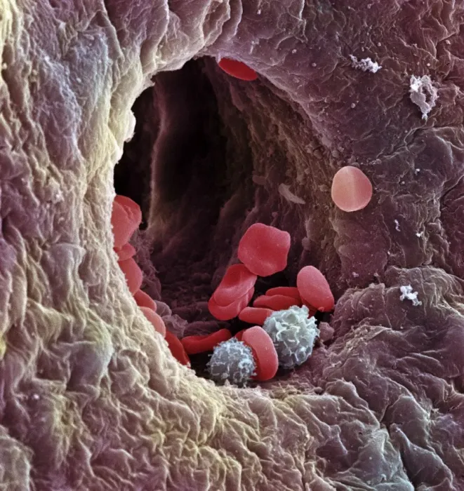 Framed Print : Liver Capillary Print, SEM Image Framed Print : Liver Capillary Print, SEM Image