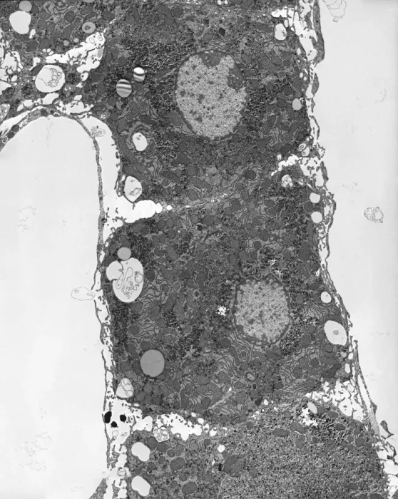 Framed Print : TEM Liver Tissue Print Framed Print : TEM Liver Tissue Print