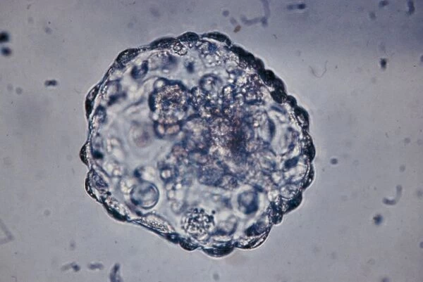 LM of blastocyst (six day embryo) after hatching