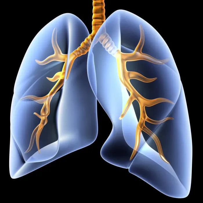 Framed Print : Lungs and bronchial tree Print Framed Print : Lungs and bronchial tree Print