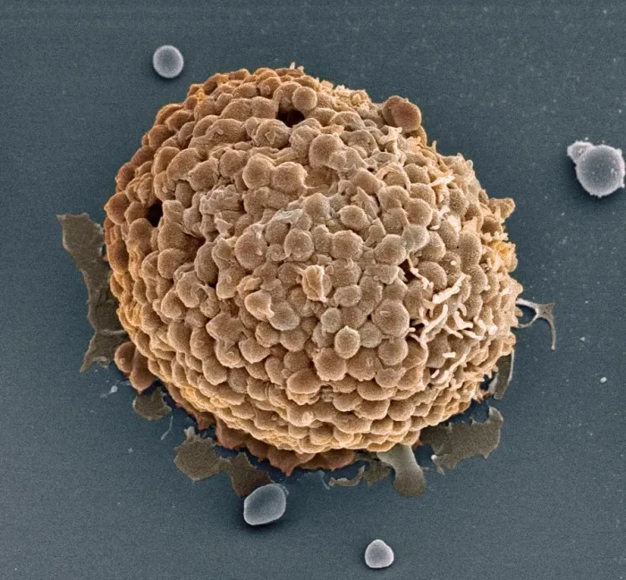 Framed Print : Mast Cell Print, SEM Image Framed Print : Mast Cell Print, SEM Image