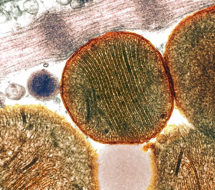 Framed Print : Mitochondria Print - Coloured Transmission Electron Micrograph Framed Print : Mitochondria Print - Coloured Transmission Electron Micrograph