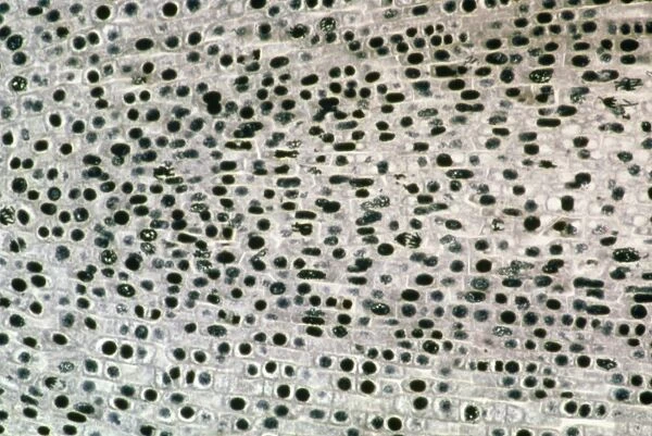 Mitosis in root tip of Broad Bean, LM