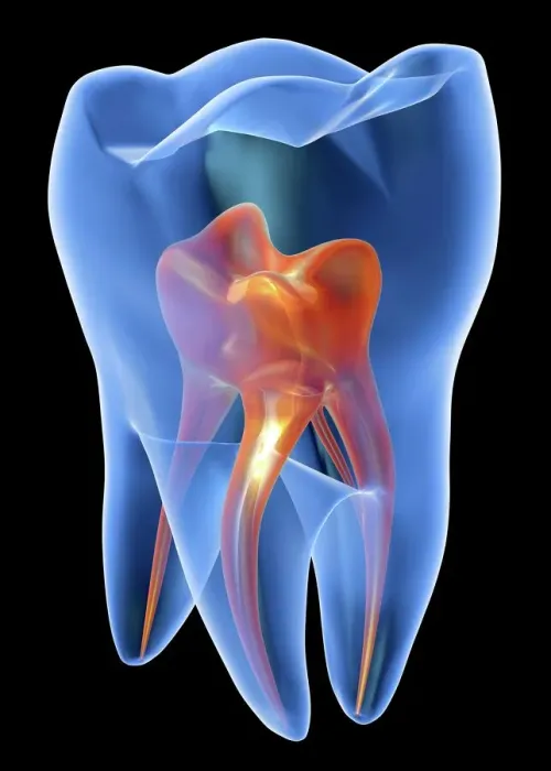 Framed Print : Molar Tooth Transparent Print Framed Print : Molar Tooth Transparent Print