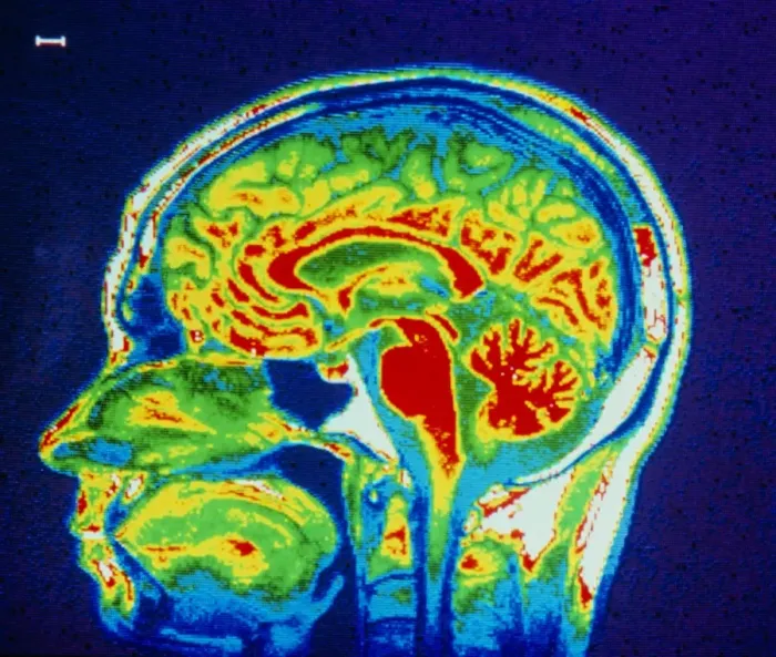 Framed Print : False-colour MRI scan print of a human brain