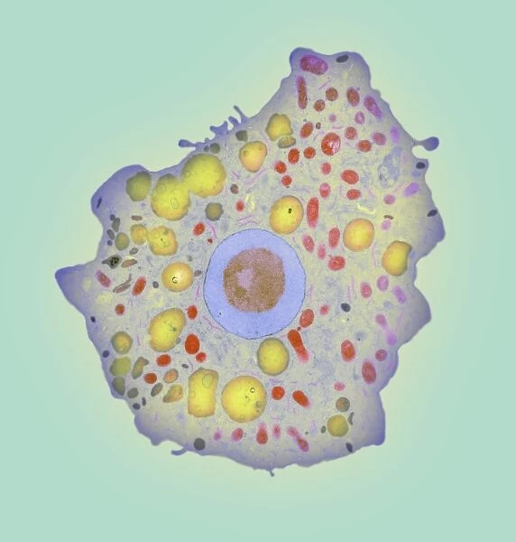 Naegleria fowleri protozoan, TEM