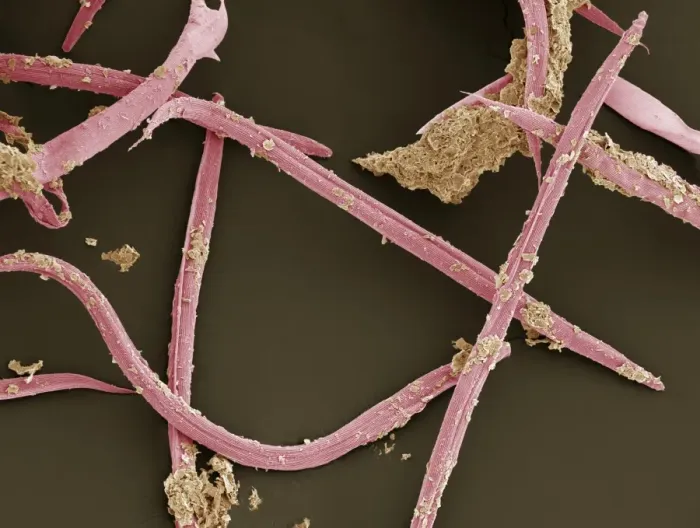 Framed Print : Print of Scanning Electron Micrograph (SEM) Nematode Worms Framed Print : Print of Scanning Electron Micrograph (SEM) Nematode Worms