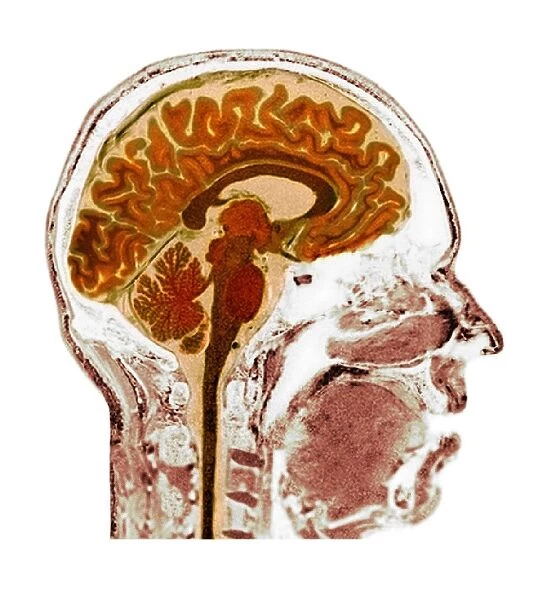 Normal human brain, MRI scan C016  /  8848