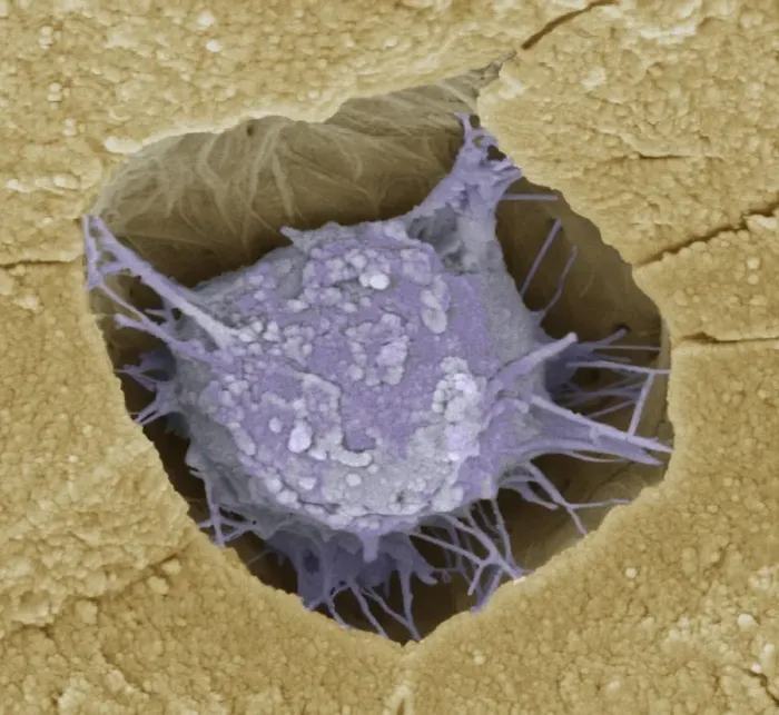 Framed Print : SEM Print of Osteoblast Bone Cell Framed Print : SEM Print of Osteoblast Bone Cell