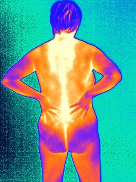 Back pain, thermogram
