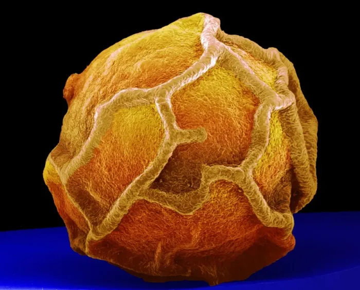 Framed Print : Coloured SEM Print of a Peppercorn Framed Print : Coloured SEM Print of a Peppercorn