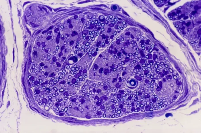 Framed Print : Peripheral nerve print, x200 magnification